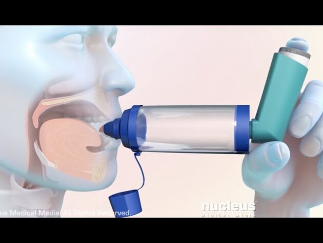 Budecort 200 Inhaler - Image 3